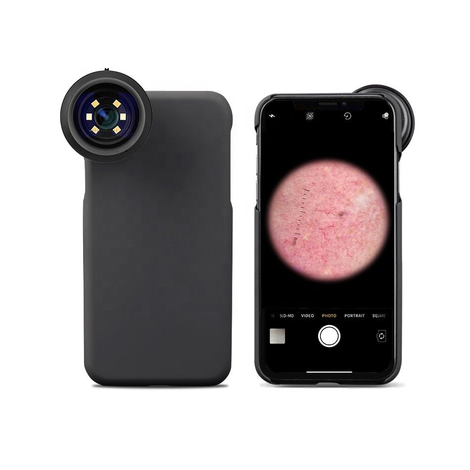 Smartphone DE - 300 Dermatoscope - Dermatoscope Plus - Front and back side views - Best dermatoscope - smartphone compatible dermatoscope - buy dermatoscope - dermatoscope