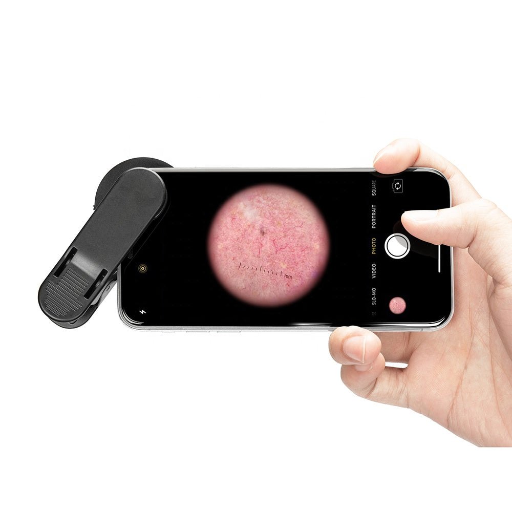 Smartphone DE - 300 Dermatoscope - Dermatoscope Plus - image view - Best dermatoscope - smartphone compatible dermatoscope - buy dermatoscope  - dermatoscope